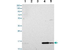 Western blot analysis of Lane 1: RT-4 Lane 2: U-251 MG Lane 3: Human Plasma Lane 4: Liver Lane 5: Tonsil with DUSP23 polyclonal antibody .