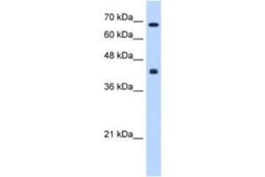 Western Blotting (WB) image for anti-Carbohydrate (N-Acetylgalactosamine 4-0) Sulfotransferase 8 (CHST8) antibody (ABIN2463289) (CHST8 antibody)