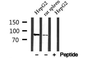 Western blot analysis of extracts from rat spleen and HepG2, using SFRS18 Antibody.