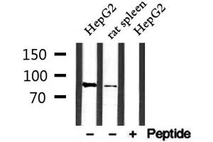 Western blot analysis of extracts from rat spleen and HepG2, using SFRS18 Antibody. (SFRS18 antibody  (Internal Region))