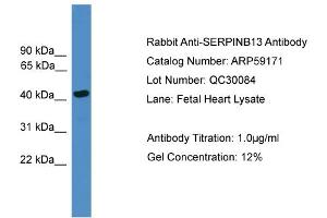 WB Suggested Anti-SERPINB13  Antibody Titration: 0. (SERPINB13 antibody  (Middle Region))