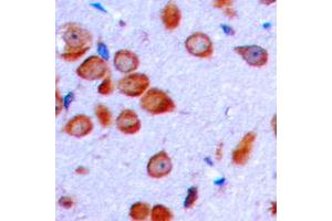 Immunohistochemical analysis of LT beta staining in human brain formalin fixed paraffin embedded tissue section. (LTB antibody  (C-Term))