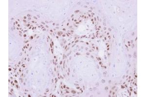 IHC-P Image Immunohistochemical analysis of paraffin-embedded Ca922 xenograft , using MAGEA11, antibody at 1:500 dilution. (MAGEA11 antibody  (N-Term))