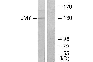 Western blot analysis of extracts from COLO cells, using JMY antibody.