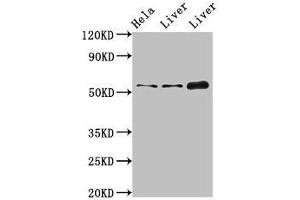 Western Blot Positive WB detected in: Hela whole cell lysate, Rat liver tissue, Mouse liver tissue All lanes: IFIT1 antibody at 4 μg/mL Secondary Goat polyclonal to rabbit IgG at 1/50000 dilution Predicted band size: 56, 52 kDa Observed band size: 56 kDa (IFIT1 antibody  (AA 1-181))
