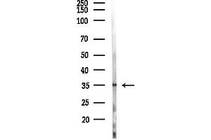 anti-Crystallin, mu (CRYM) (Internal Region) antibody