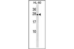 Western blot analysis of PGRMC2 Antibody (C-term) in HL-60 cell line lysates (35ug/lane). (PGRMC2 antibody  (C-Term))