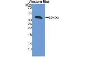 Detection of Recombinant KRT13, Human using Polyclonal Antibody to Cytokeratin 13 (CK13) (Cytokeratin 13 antibody  (AA 104-403))