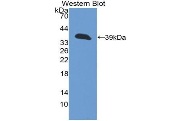 Cytokeratin 13 antibody  (AA 104-403)