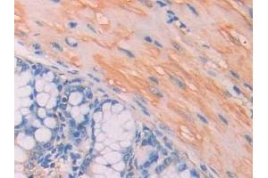Detection of CA7 in Mouse Colon Tissue using Polyclonal Antibody to Carbonic Anhydrase VII (CA7) (CA7 antibody  (AA 58-217))