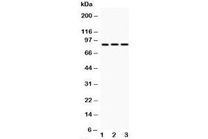 Western blot testing of CD18 antibody and Lane 1:  HeLa;  2: Jurkat;  3: HT1080;  Predicted/Observed size: 85~95KD depending on glycosylation level (Integrin beta 2 antibody  (N-Term))