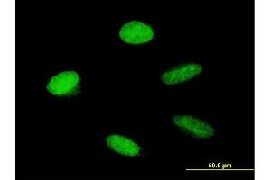 Immunofluorescence of purified MaxPab antibody to HMGA1 on HeLa cell. (HMGA1 antibody  (AA 1-96))