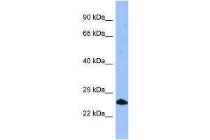 WB Suggested Anti-SMN1 Antibody Titration: 1. (SMN1 antibody  (C-Term))