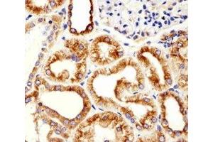 Immunohistochemical analysis of paraffin-embedded human kidney using beta-Tubulin antibody at 1:25 dilution. (TUBB1 antibody)