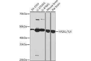 Western Blotting (WB) image for anti-Nuclear Receptor Subfamily 2, Group E, Member 1 (NR2E1) antibody (ABIN7269014)