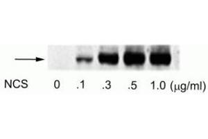 Western blot of human melanoma cells incubated with varying doses of the radiomimetic drug NCS showing specific immunolabeling of the ~74 kDa ATF2 protein phosphorylated at Ser490 and Ser498. (ATF2 antibody  (pSer490, pSer498))