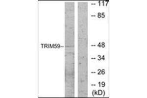 Western blot analysis of extracts from NIH-3T3 cells, using TRIM59 Antibody . (TRIM59 antibody  (Internal Region))