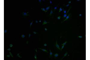 Immunofluorescence staining of U251 cells with ABIN7146149 at 1:100, counter-stained with DAPI. (C1GALT1C1 antibody  (AA 27-318))