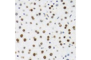 Immunohistochemistry of paraffin-embedded mouse liver using H2AFX antibody.