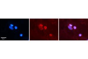Rabbit Anti-NR1I2 Antibody    Formalin Fixed Paraffin Embedded Tissue: Human Adult heart  Observed Staining: Nuclei in adipocytes but not in cardiomyocytes Primary Antibody Concentration: 1:100 Secondary Antibody: Donkey anti-Rabbit-Cy2/3 Secondary Antibody Concentration: 1:200 Magnification: 20X Exposure Time: 0. (NR1I2 antibody  (N-Term))