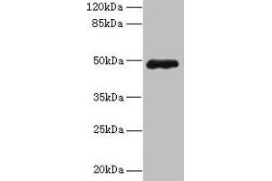 Western blot All lanes: ZNF562 antibody at 12 μg/mL + 293T whole cell lysate Secondary Goat polyclonal to rabbit IgG at 1/10000 dilution Predicted band size: 49, 41 kDa Observed band size: 49 kDa (ZNF562 antibody  (AA 201-426))