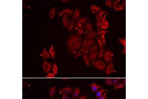 Immunofluorescence analysis of U2OS cells using PAICS Polyclonal Antibody (PAICS antibody)