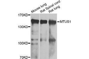 Western blot analysis of extracts of various cell lines, using MTUS1 antibody. (MTUS1 antibody)