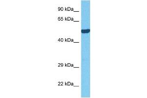 Host:  Rabbit  Target Name:  OASL  Sample Tissue:  Mouse Kidney  Antibody Dilution:  1ug/ml (OASL antibody  (C-Term))