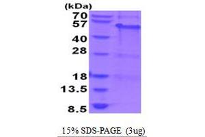 SDS-PAGE (SDS) image for Melanoma Antigen Family A, 8 (MAGEA8) (AA 1-318) protein (His tag) (ABIN6387573) (MAGEA8 Protein (AA 1-318) (His tag))
