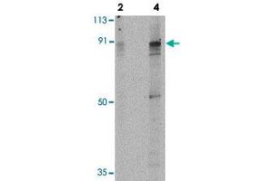 Western blot analysis of PAK7 in T24 lysate with PAK7 polyclonal antibody  at 2 and 4 ug/mL . (PAK7 antibody  (Internal Region))