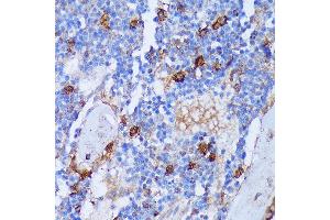 Immunohistochemistry of paraffin-embedded Rat bone marrow using P antibody (ABIN7269207) at dilution of 1:100 (40x lens). (PAD4 antibody  (AA 374-550))