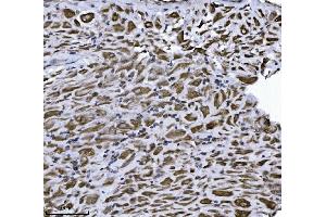 IHC analysis of ERLIN2 using anti-ERLIN2 antibody (ABIN7602582). (ERLIN2 antibody  (AA 87-339))
