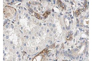 ABIN6279570 at 1/100 staining Human kidney tissue by IHC-P. (NNT antibody  (C-Term))