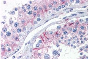 Human Testis: Formalin-Fixed, Paraffin-Embedded (FFPE) (ZYX antibody  (AA 1-573))