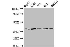 Western Blot Positive WB detected in: HepG2 whole cell lysate, A549 whole cell lysate, PC-3 whole cell lysate, Hela whole cell lysate, HEK293 whole cell lysate All lanes: CRK antibody at 3 μg/mL Secondary Goat polyclonal to rabbit IgG at 1/50000 dilution Predicted band size: 34, 23 kDa Observed band size: 37 kDa (Crk antibody  (AA 40-196))