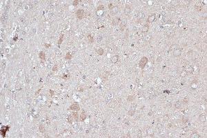 Immunohistochemistry of paraffin-embedded rat brain using MAP1LC3B antibody. (LC3B antibody)