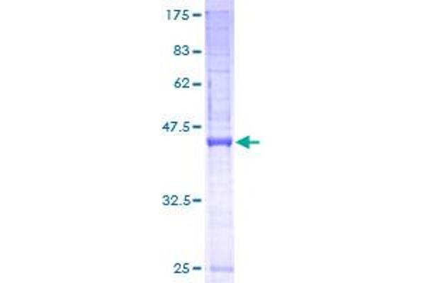 SSR3 Protein (AA 1-185) (GST tag)