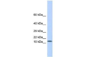 LGALS1 antibody used at 1 ug/ml to detect target protein.