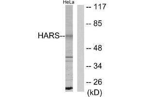 Western blot analysis of extracts from HeLa cells, using HARS antibody. (HARS1/Jo-1 antibody  (C-Term))