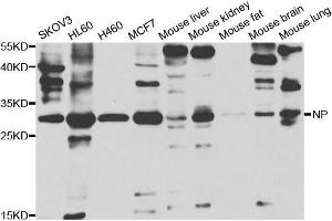 Western blot analysis of extracts of various cell lines, using PNP antibody. (NP antibody)