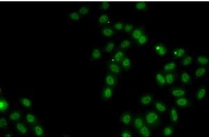 Immunofluorescence analysis of MCF7 cells using SOX5 Polyclonal Antibody (SOX5 antibody)