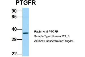 Host: Rabbit Target Name: PTGFR Sample Type: Human 721_B Antibody Dilution: 1. (PTGFR antibody  (C-Term))