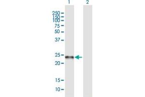 Western Blot analysis of C19orf50 expression in transfected 293T cell line ( H00079036-T01 ) by C19orf50 MaxPab polyclonal antibody. (C19orf50 antibody  (AA 1-176))