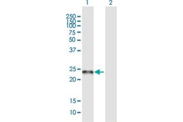 C19orf50 Antikörper  (AA 1-176)