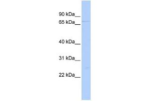 WB Suggested Anti-DDX59 Antibody Titration:  0.