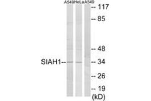 Western blot analysis of extracts from A549/HeLa cells, using SIAH1 Antibody. (SIAH1 antibody  (AA 181-230))