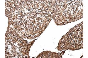 IHC-P Image B-Raf antibody [N2C1], Internal detects B-Raf protein at cytosol on mouse testis by immunohistochemical analysis. (SNRPE antibody  (Internal Region))