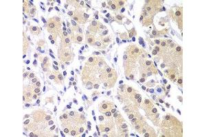 Immunohistochemistry of paraffin-embedded Human gastric using CHEK1 Polyclonal Antibody at dilution of 1:100 (40x lens). (CHEK1 antibody)