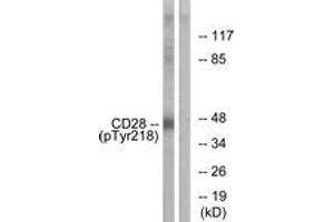 Western blot analysis of extracts from HepG2 cells treated with nocodazole 1ug/ml 16h, using CD28 (Phospho-Tyr218) Antibody. (CD28 antibody  (pTyr218))