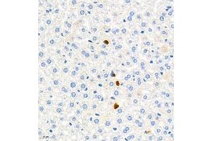 Immunohistochemistry (Paraffin-embedded Sections) (IHC (p)) image for anti-Lymphocyte Antigen 6 Complex, Locus G (Ly6g) antibody (ABIN7074524)
